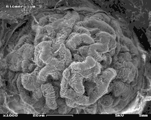 Glomerulus im Rasterelektronenmikroskop (REM)Bildbreite ca. 115 µm
