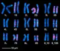 Chromosomenkarte X. laevis , Karyotyp