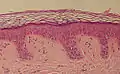 normale Haut, histologisch
