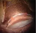 zweiteilige Spermathek der Rote Chile-Vogelspinne (Grammostola rosea)